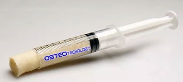 Tessuto osseo granulare liofilizzato con collagene